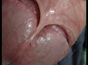 virgin penis very close up seen and show skin lock be proper of penis freak