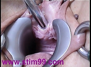 Peehole take effect having it away urethral advisable insertion distension